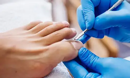 Studio Kinesthetic - Galerija - Medicinski pedikir